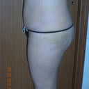 1 week after-profile