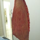 1 of msny pieces of excess skin thta was removed. Total weight 3kgs.