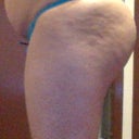 SIDE BEFORE