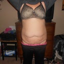 pre op