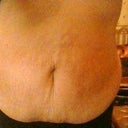 Sorry picture not that great so hard taking one of your tummy on the phone, disgusting can't wait till it goes x
