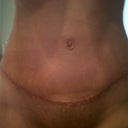 Tummy scar( so swollen) 4 weeks