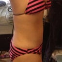 14wk left side
