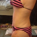 14 wk right side
