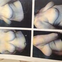 Photos the doctor took.