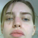 Front view.