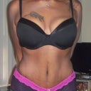 5 weeks post op
