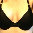 One  month post op