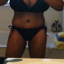 1 month post op size 6