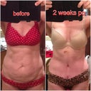 I love comparison pictures- good reminder of what was-2 weeks po