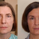 Before & after