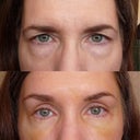Before & after