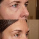 Before & after