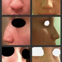 Before and After---it's easier to notice the difference this way :]