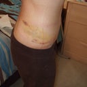1 week post op. looked good to me 

AM photo