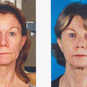 Before and After