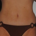 5 weeks after
