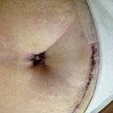 Close up of belly button