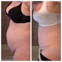 12dpo, even with my bump and swelling its so worth it :)