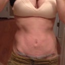 post op 18