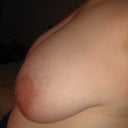 Left side before boobie!