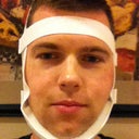 Minutes after surgery - chin compression garment to minize swelling and brusing