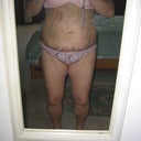 Day 4 after
