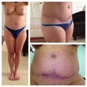 This is today 5 1/2 month.  So much better!!  Now you see what revisions will need to be addressed.  1/6/13