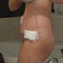 3 days PO-  swollen!