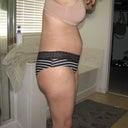 12 days post op i really hope this is still swelling