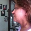 Day three. Swelling is pretty steady but not worse. The right side is a bit more swollen, but I do not mind.
