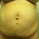 Here it's is. 100% me. Well me and my gallbladder scars lol