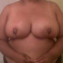 And here are my new buddies. Swollen, leaky, and lifted. Whoop whoop.