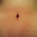 8/7
Close up of BB, very purple around, I pealed off the scab & it scared ugly