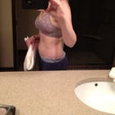 Four weeks post op. 32C bra!