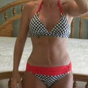 10 wks post surgery