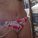 post op day 9 side