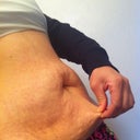 Skin. Can't wait till its gone!!!