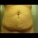 Sucking it in. Hello c-section scar!