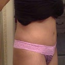 and after....12 weeks po