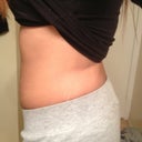 Side view before pic