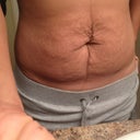 Before pic front