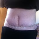 14 po sad crease in middle?  swollen?