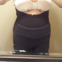 one day post op