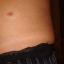 rrrrrrr.I hate that scar..