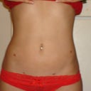 7 weeks post