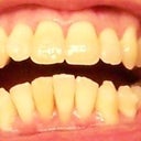 8-15-2012 Tray 12/24