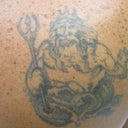 Before 1st treatment