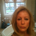 Me one week prior to upper eye lid surgery