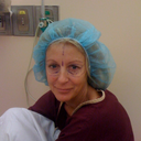 Pre-op, eyes marked with marker to show where laser resurfacing should be done